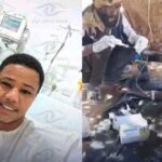 جرحى الدعم السريع يلجؤون للعلاج بـ”بول البعير”