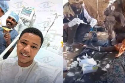 جرحى الدعم السريع يلجؤون للعلاج بـ”بول البعير”