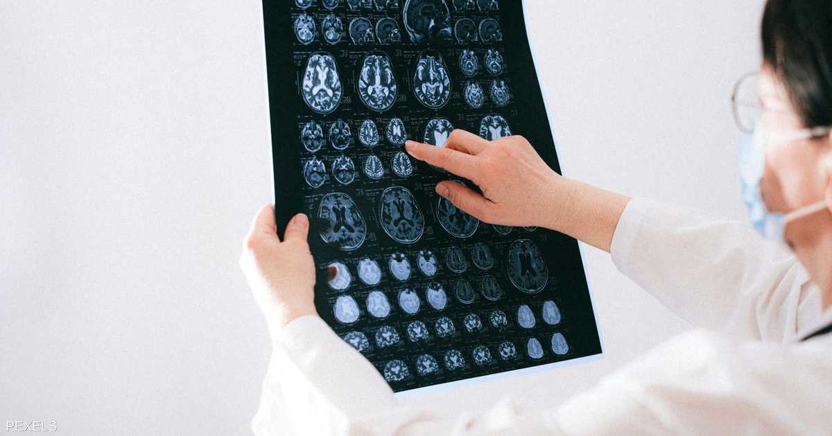 نصائح علمية لإبطاء تدهور الدماغ مع التقدم في السن.