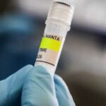 فيروس هانتا على السفينة هونديوس: خطر التفشي واسع النطاق ضعيف ونسخة السلالة النادرة قابلة للانتقال بين البشر