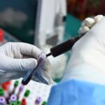 الخلايا الجذعية التائية ذات الذاكرة تُحقق استجابة كاملة أعلى في علاج سرطانات الدم مقارنة بخلايا كار-تي العادية.