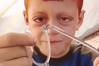 الأمل يبقى قيد الطلب: أيوب الضعيف بصرياً في غزة يحتاج علاجاً عاجلاً بعد حصوله على نظارة جديدة غير دقيقة.