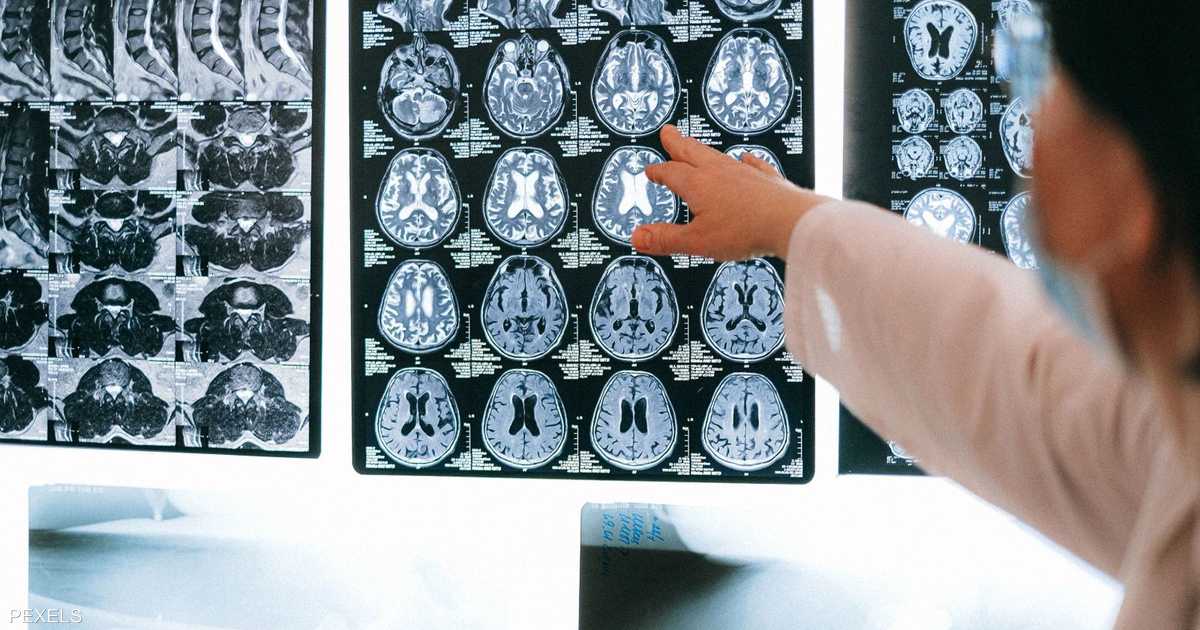 منتصف العمر.. آخر فرصة لخفض مخاطر الإصابة بالخرف