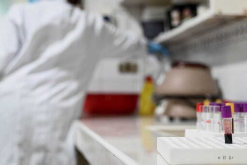 الإيدز: 570 ألف وفاة في 2025 تتعدى ضعف الهدف العالمي وتحذير من عودة المرض للتصاعد