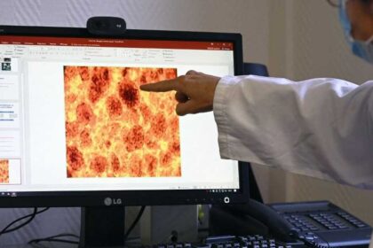 لقاح يستهدف طفرة كيراس يولد استجابات مناعية طويلة الأمد في تجربة أولى على البشر