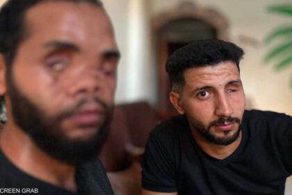محمد وموسى: جراح غيرتا حياتهما وانتظارهما العلاج خارج غزة بعد عام من الإصابة البالغة