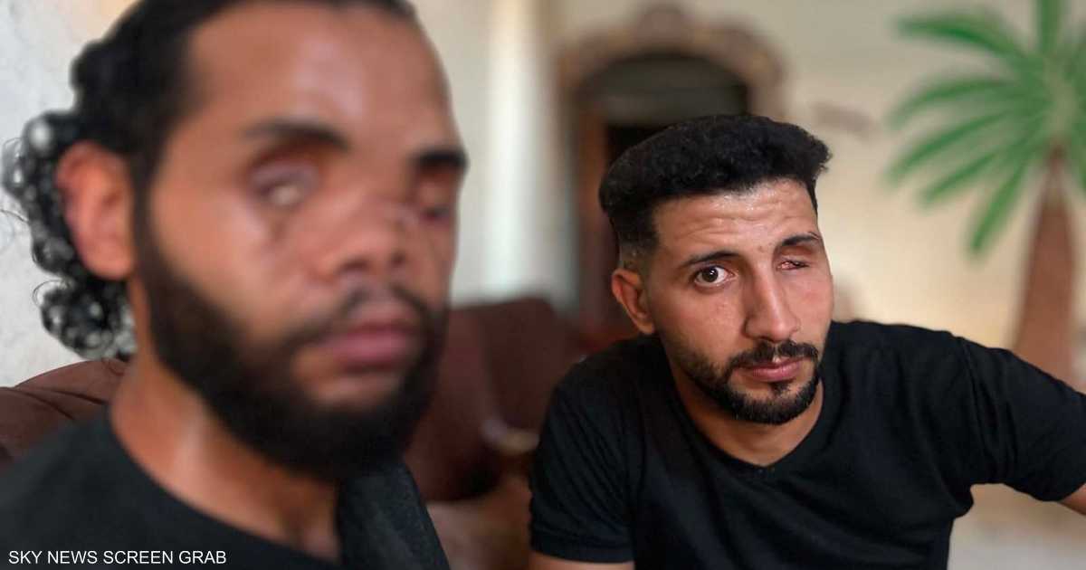 محمد وموسى: جراح غيرتا حياتهما وانتظارهما العلاج خارج غزة بعد عام من الإصابة البالغة