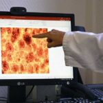 دواء جديد يضاعف متوسط البقاء لدى مرضى سرطان البنكرياس النقيلي