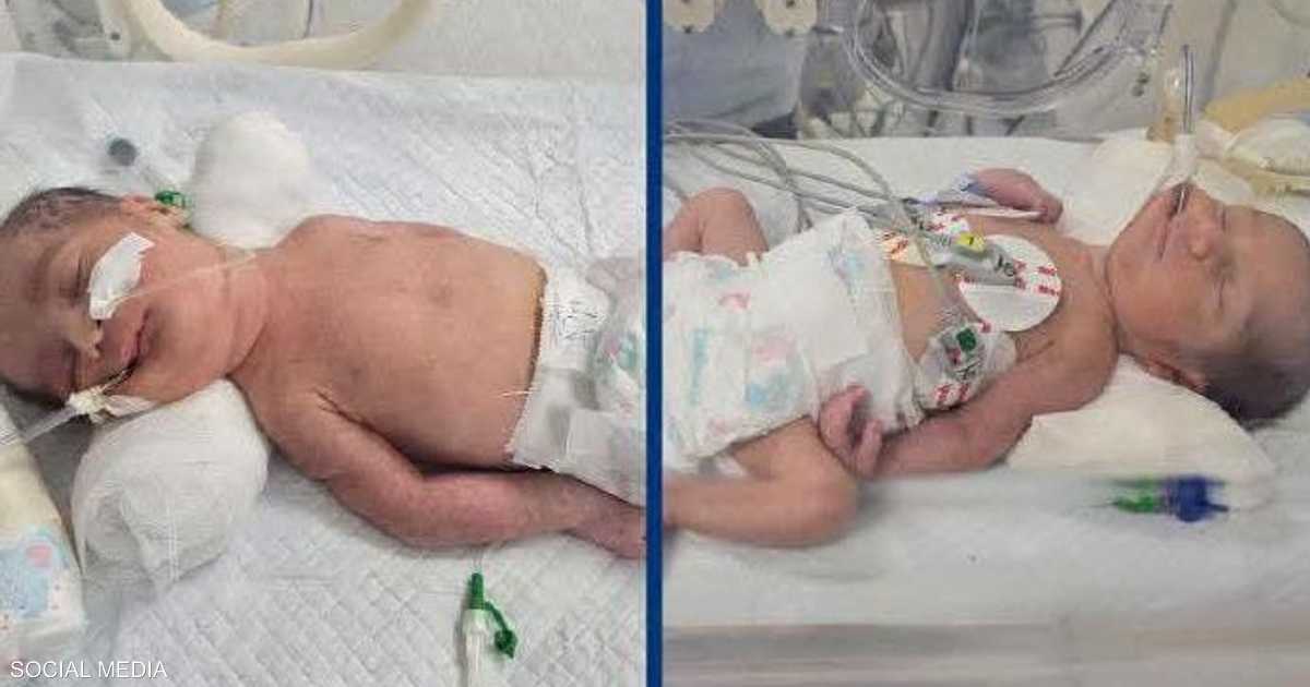 الأم توفيت وولديا توأم نجاتا بسرعة استجابة الفريق الطبي لاستخراجهما قبل وفاتها