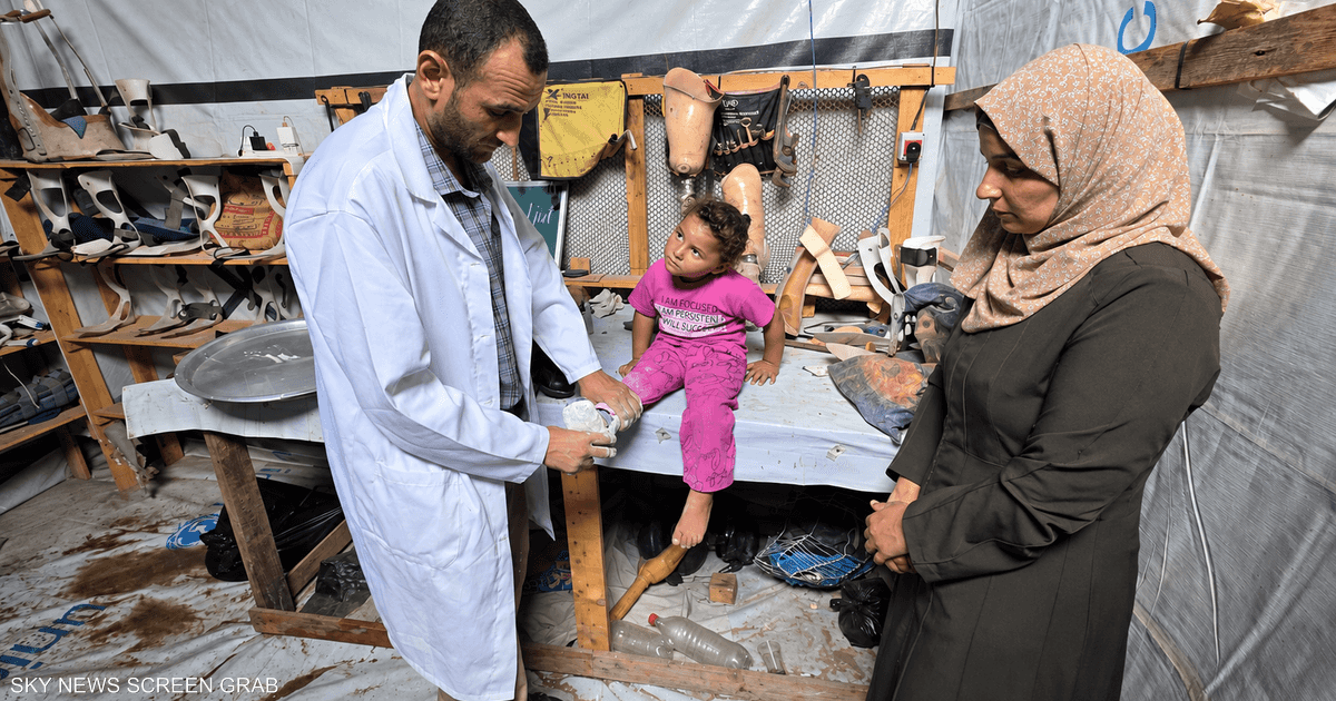 الخالدي يصنع جهاز تقويمي لطفلة تعاني إعاقة حركية منذ الولادة للمساعدة في المشي