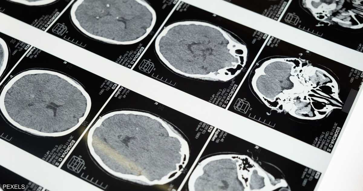 الدماغ يتكون من نظامين عصبيين منفصلين تطوراً بشكل مستقل قبل الجمع في الجمجمة.