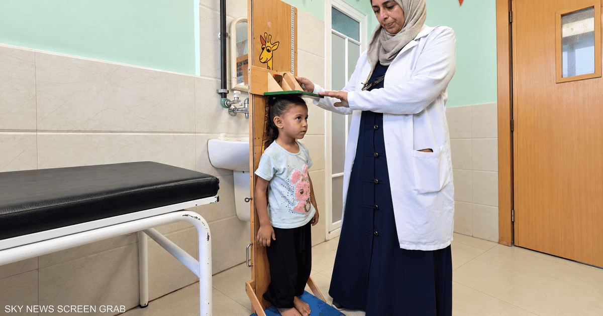 الأزمة الصحية تتفاقم: قصر قامة ونحول شديد بين أطفال النازحين في غزة