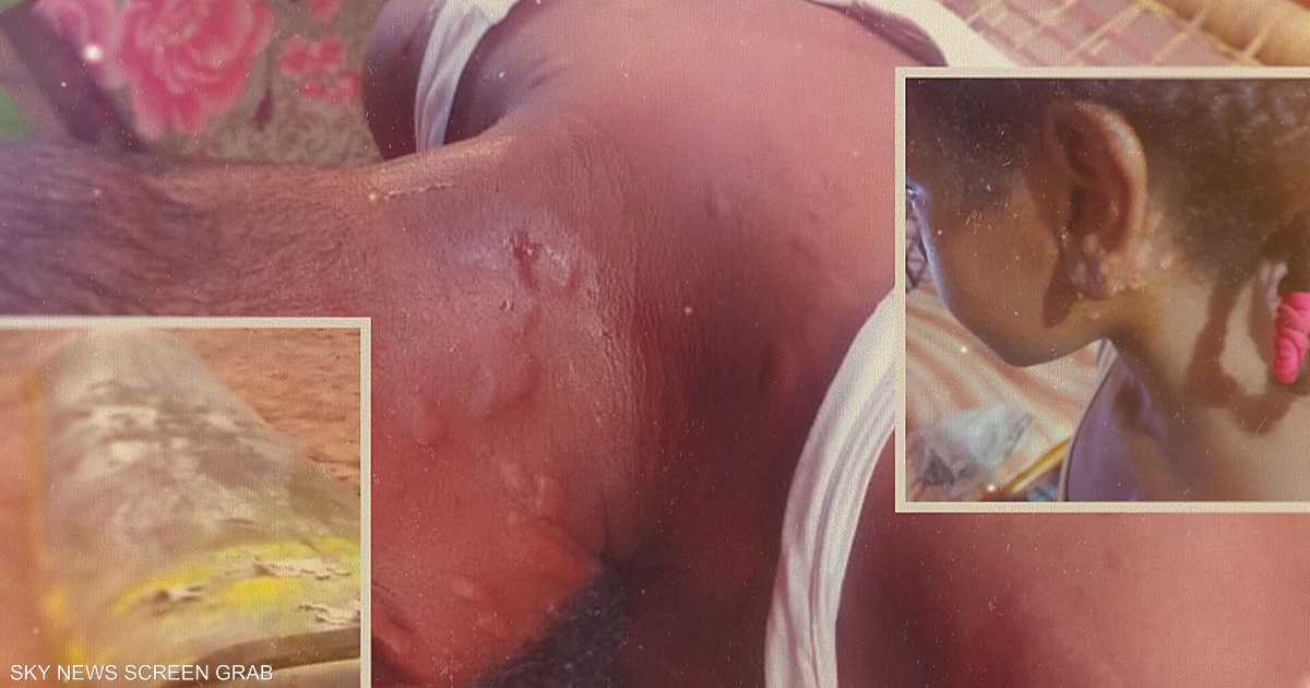 ملف يكشف جهود الجيش السوداني لتطوير ذخائر كيميائية بالكلور ضد قوات الدعم السريع.