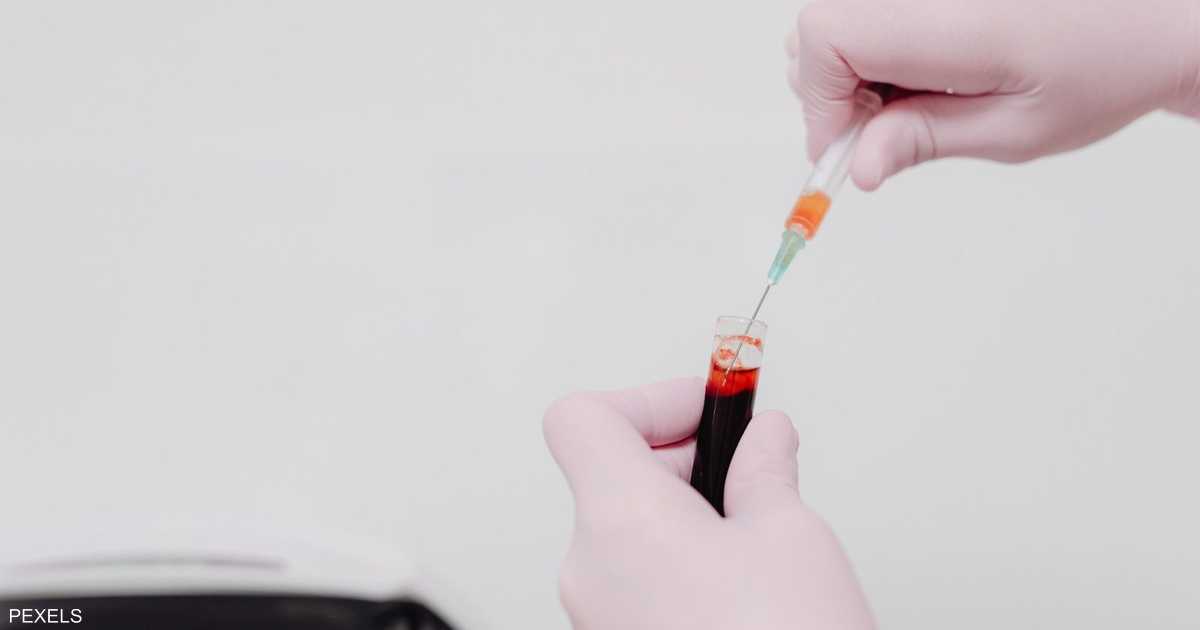 انخفاض إنزيمات الكبد يرتبط بزيادة خطر سرطان القولون المبكر لدى الشباب